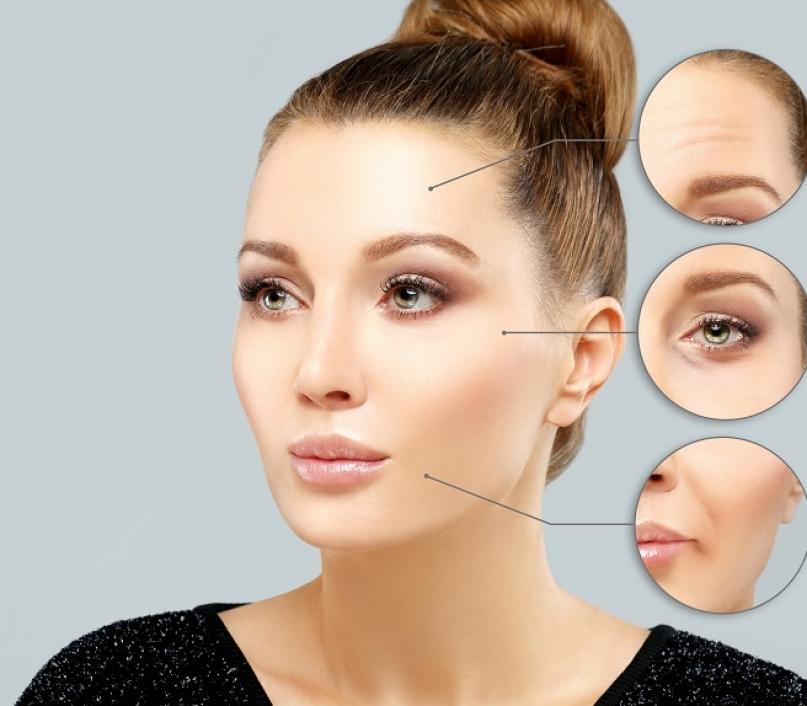 Tutto-quello-che-ce-da-sapere-sul-baby-botox2.jpg